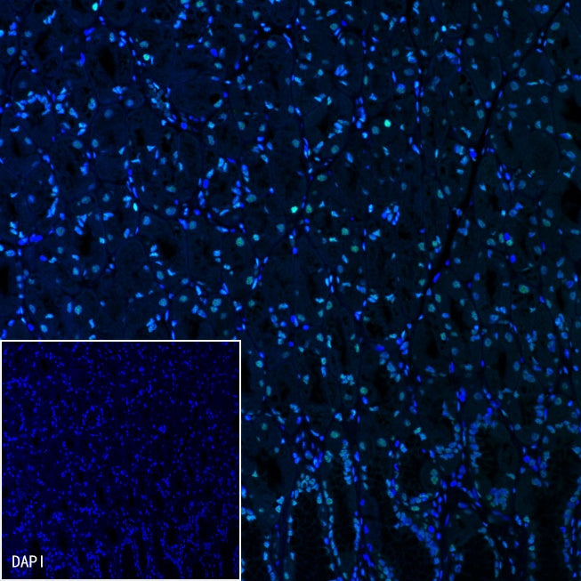 Histone H3 (acetyl K4 + K9 + K18) Rabbit polyclonal antibody