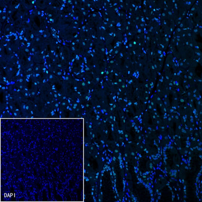 Histone H3 (acetyl K4 + K9 + K18) Rabbit polyclonal antibody