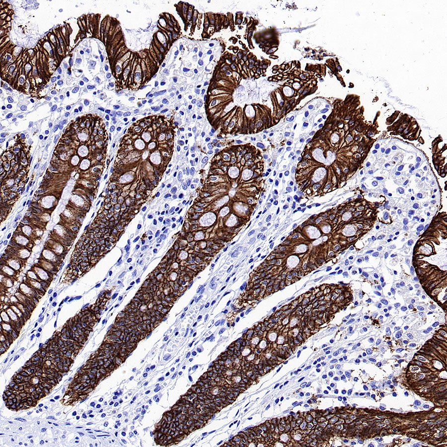 CDH17 Recombinant Rabbit mAb (SDT-3276-46)