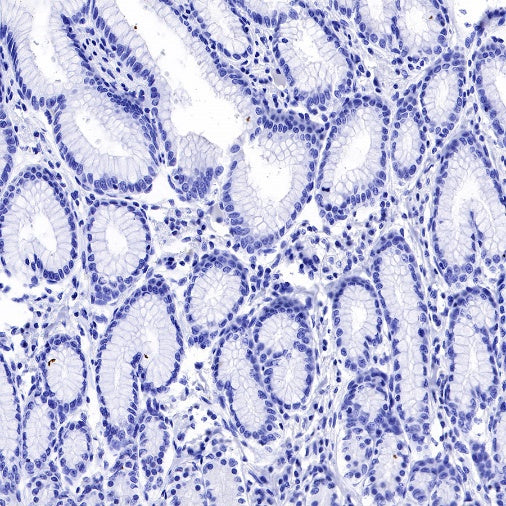 Claudin 6 Recombinant Rabbit mAb (S-521-63)