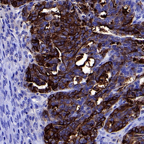 PLAP+ALPI Recombinant Rabbit mAb (SDT-167-155)