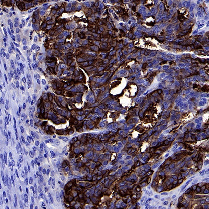 PLAP+ALPI Recombinant Rabbit mAb (SDT-167-155)