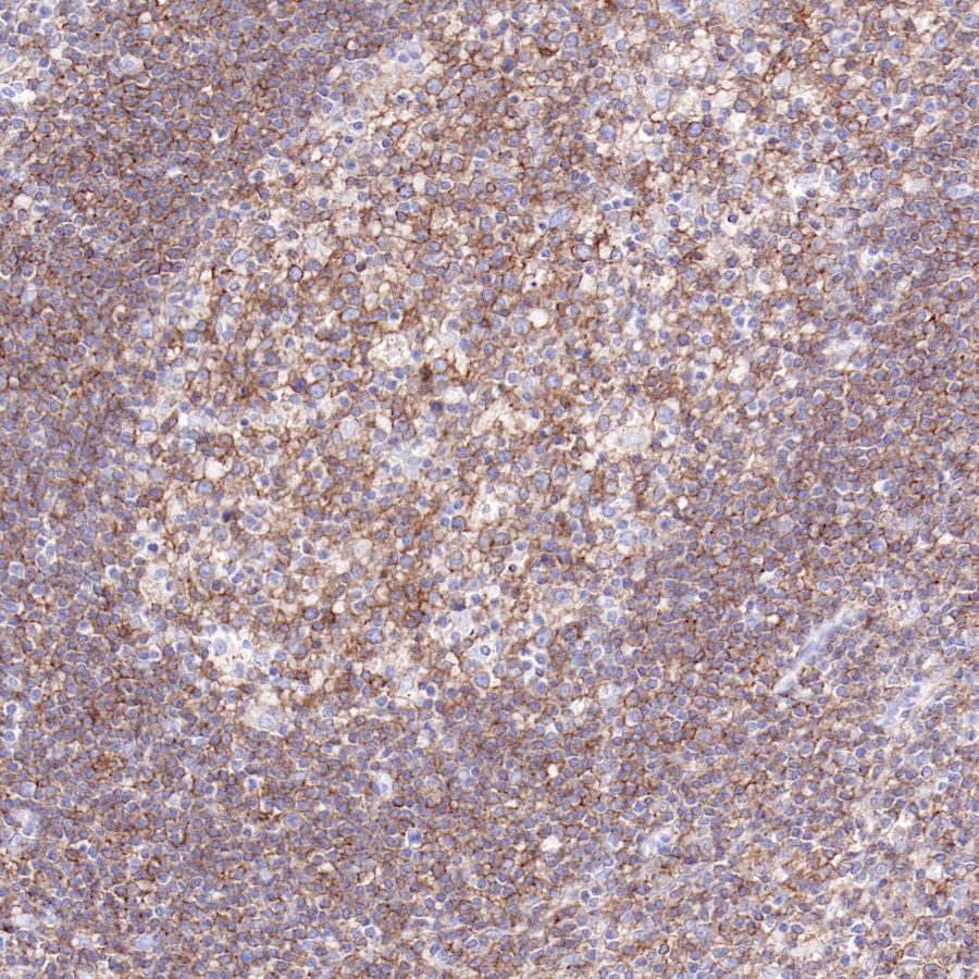 CD40 Recombinant Rabbit mAb,PBS Only (SDT-145-45)