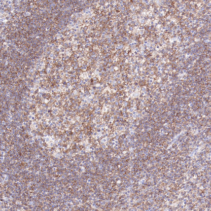 CD40 Recombinant Rabbit mAb,PBS Only (SDT-145-45)