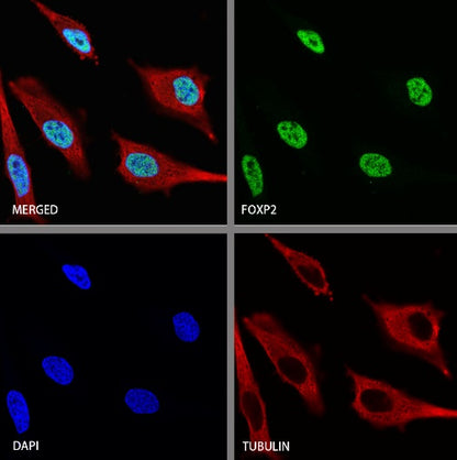 FOXP2 Recombinant Rabbit mAb (S-2342-8)