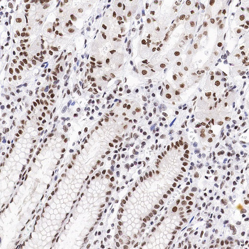 RBM15B Recombinant Rabbit mAb (S-1326-111)
