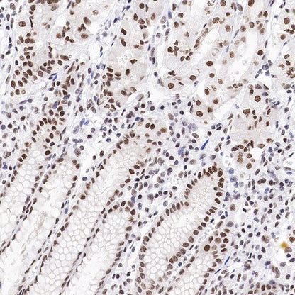 RBM15B Recombinant Rabbit mAb (S-1326-111)