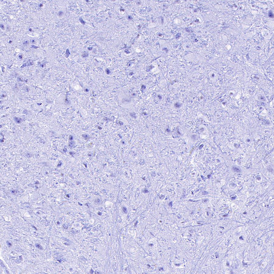 Cytokeratin 1 Recombinant Rabbit mAb (SDT-3225-22)