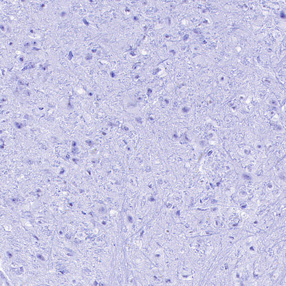 Cytokeratin 1 Recombinant Rabbit mAb (SDT-3225-22)
