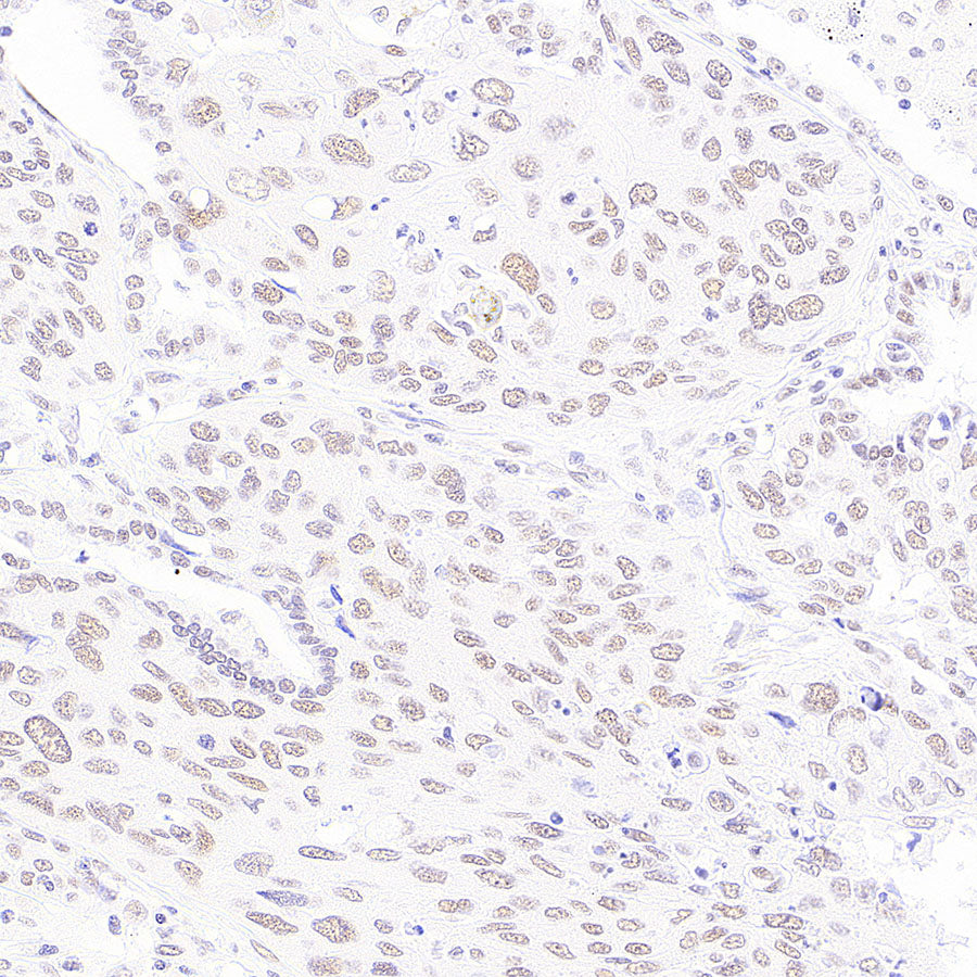 BAP1 Recombinant Rabbit mAb (S-6199)