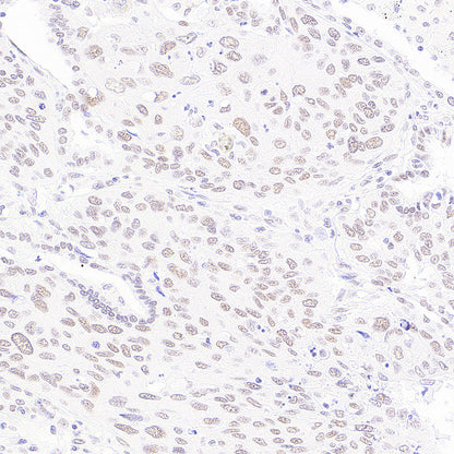 BAP1 Recombinant Rabbit mAb (S-6199)
