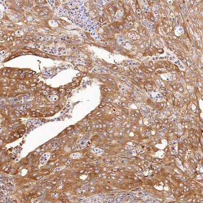 NF-κB2 p100/p52 Recombinant Rabbit mAb (S-2502-208)