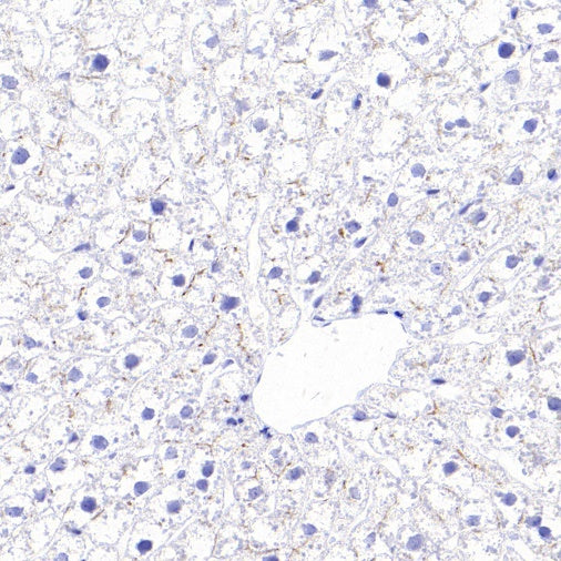 MDR3 Recombinant Rabbit mAb (SDT-1949-60)
