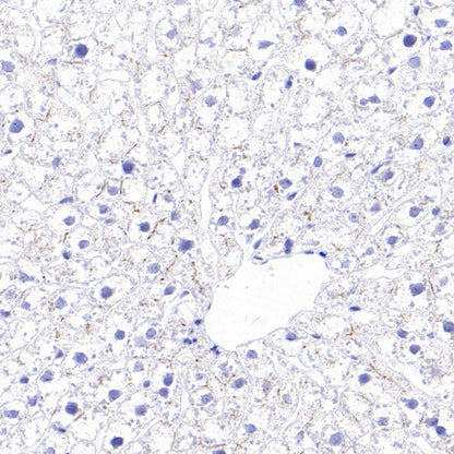 MDR3 Recombinant Rabbit mAb (SDT-1949-60)