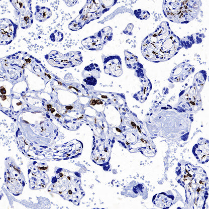 CD206 Recombinant Rabbit mAb (S-3477-27)