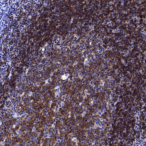 CD37 Recombinant Rabbit mAb (S-1662-61)