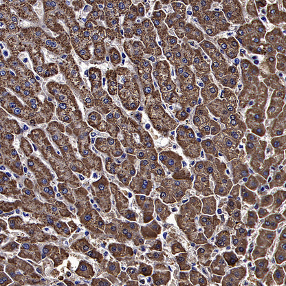 ALDH2 Recombinant Rabbit mAb (S-4173-20)