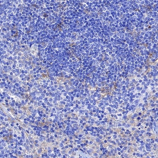 CD86 Recombinant Rabbit mAb (S-4222)