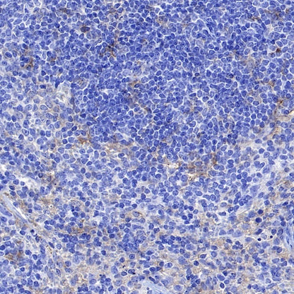 CD86 Recombinant Rabbit mAb (S-4222)
