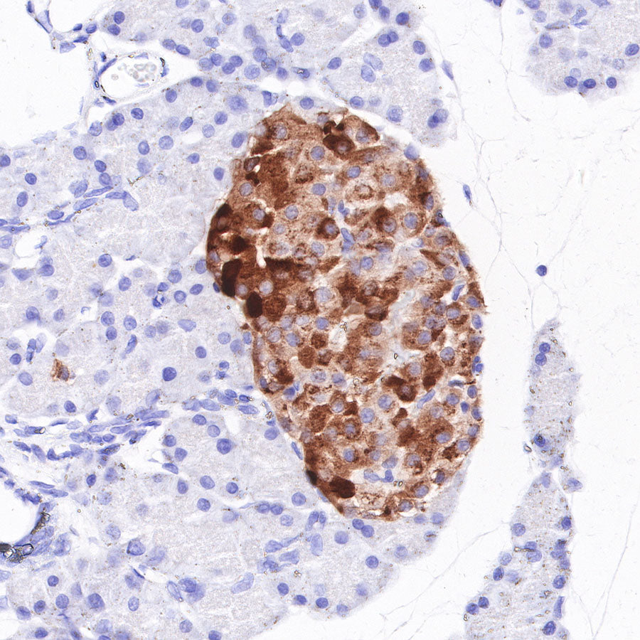 S-RMab® Chromogranin A Recombinant Rabbit mAb (SDT-074-57)