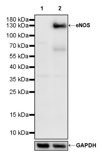 eNOS Recombinant Rabbit mAb (S-1885-94)
