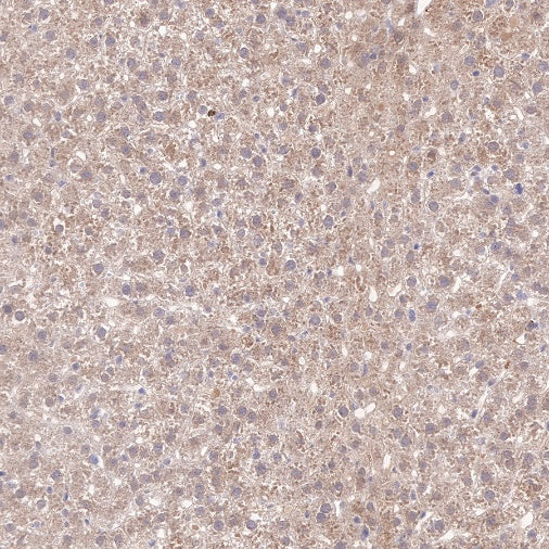 SQSTM1/p62 Recombinant Rabbit mAb (S-778-1)
