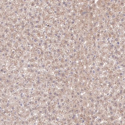 SQSTM1/p62 Recombinant Rabbit mAb (S-778-1)