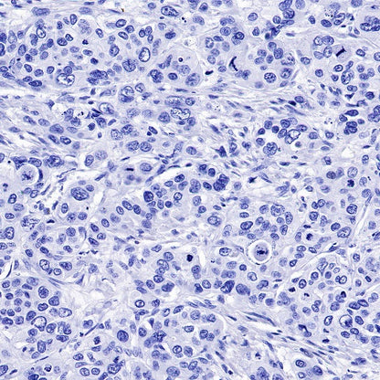 FGFR2b Recombinant Rabbit mAb (SDT-423-121)