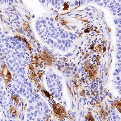 HLA-DPB1 Recombinant Rabbit mAb (S-R263)