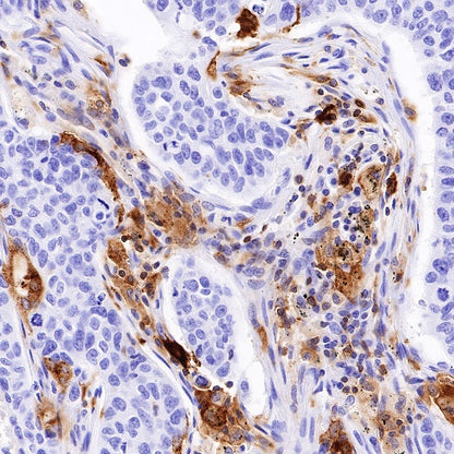 HLA-DPB1 Recombinant Rabbit mAb (S-R263)