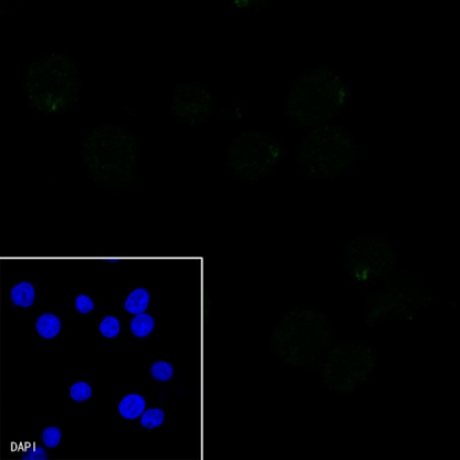S-RMab® PAX5 Recombinant Rabbit mAb (SDT-R202)
