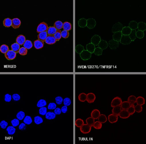 HVEM/TNFRSF14 Recombinant Rabbit mAb (S-727-70)