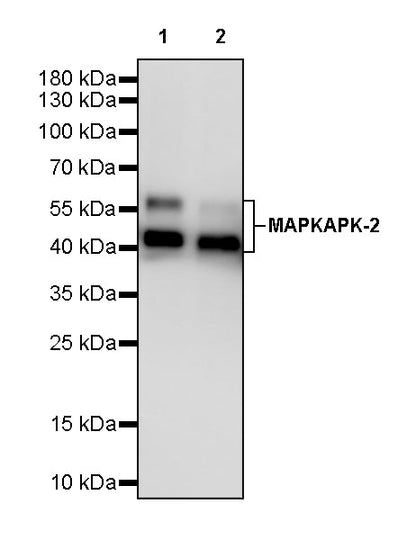 MAPKAPK-2 Recombinant Rabbit mAb (S-2641-58)