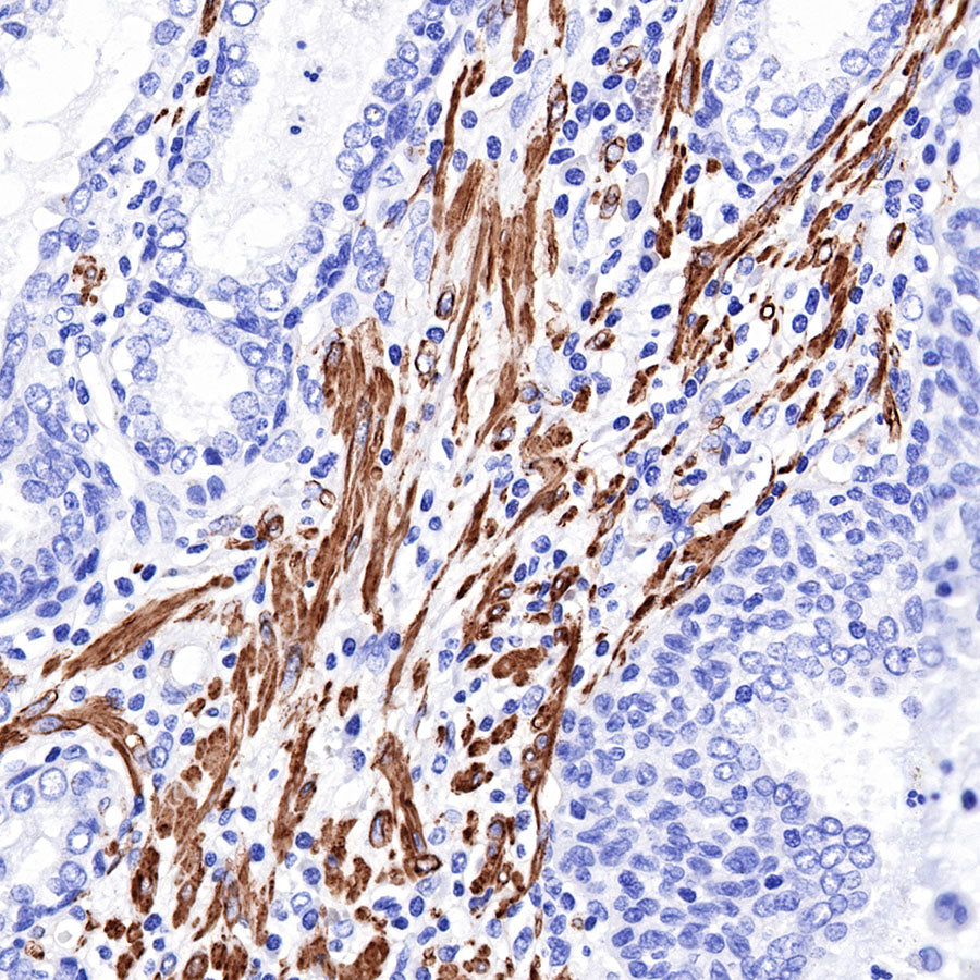 S-RMab® alpha smooth muscle Actin (SMA) Recombinant Rabbit mAb,PBS Only (SDT-301-142)