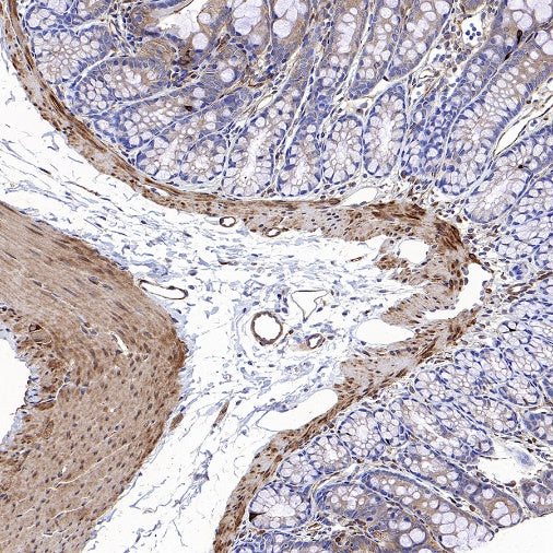 Vinculin Recombinant Rabbit mAb (S-1635-3)