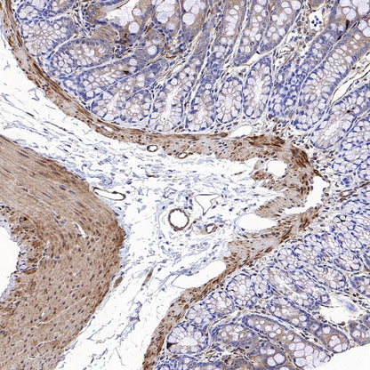 Vinculin Recombinant Rabbit mAb (S-1635-3)