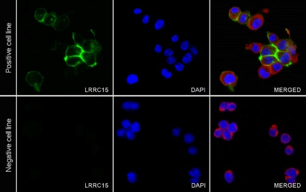 LRRC15 Recombinant Rabbit mAb (S-2473-43)