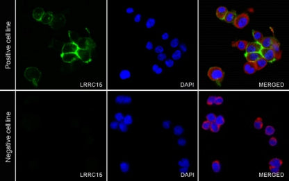 LRRC15 Recombinant Rabbit mAb (S-2473-43)