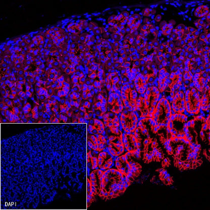 E-Cadherin Recombinant Rabbit mAb (Alexa Fluor® 555 Conjugate) (S-438-5)