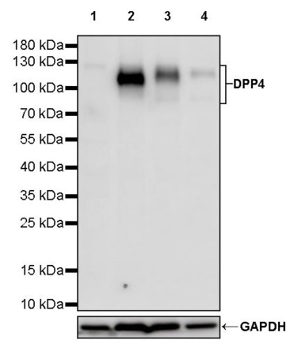 DPP4 Recombinant Rabbit mAb (S-1631-130)