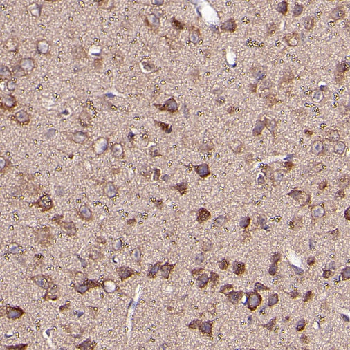 OPA1 Recombinant Rabbit mAb (S-2189-65)