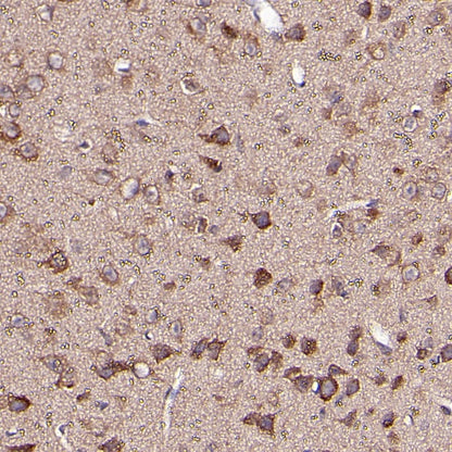 OPA1 Recombinant Rabbit mAb (S-2189-65)