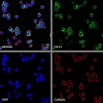 TACC3 Recombinant Rabbit mAb (S-3048-50)