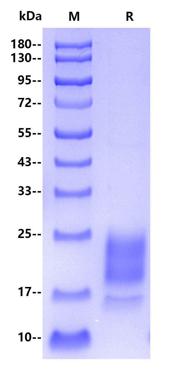 Monkeypox virus A29L His Tag Protein