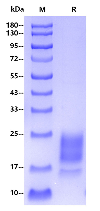 Monkeypox virus A29L His Tag Protein