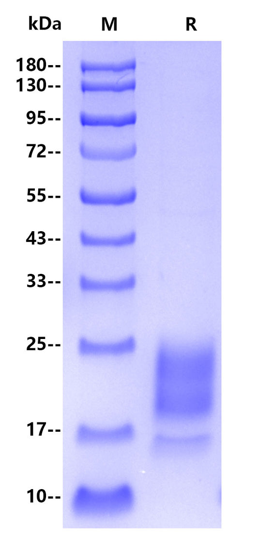 Monkeypox virus A29L His Tag Protein