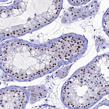 NSUN2 Mouse mAb