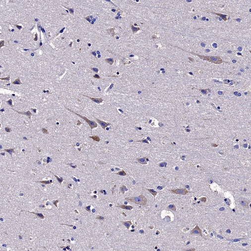 Neuropilin 1 Recombinant Rabbit mAb (S-1453-6)