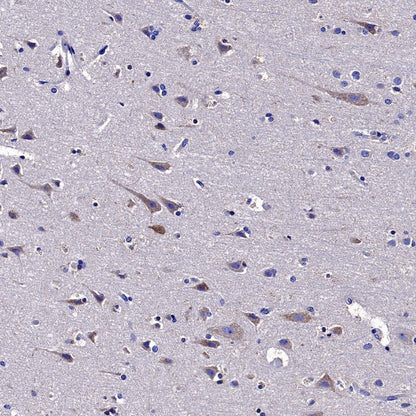 Neuropilin 1 Recombinant Rabbit mAb (S-1453-6)