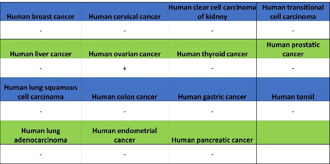 Wilms Tumor Protein (WT1) Recombinant Rabbit mAb (SDT-2864)